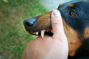 What Evidence is Important in a Dog Attack Case? What Evidence is Important in a Dog Attack Case?